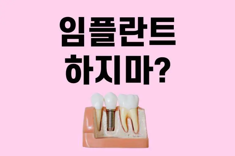 임플란트 하지마 필요없는 사람 vs 해야하는 사람